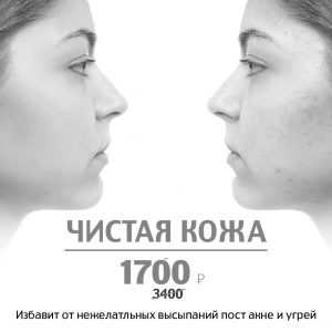 Чистая кожа